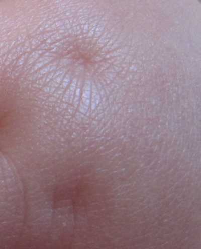 Baby skin Baby skin